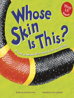 cover image of Whose Skin Is This?